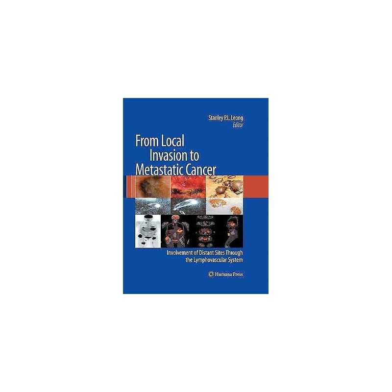 From Local Invasion to Metastatic Cancer - 9781627039437