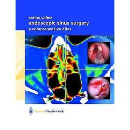 Endoscopic Sinus Surgery - 9783211837122