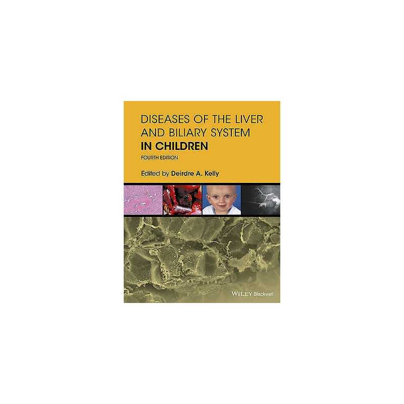 Diseases of the Liver and Biliary System in Children - 9781119046905