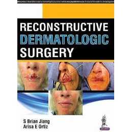 Reconstructive Dermatologic Surgery - 9789351529415