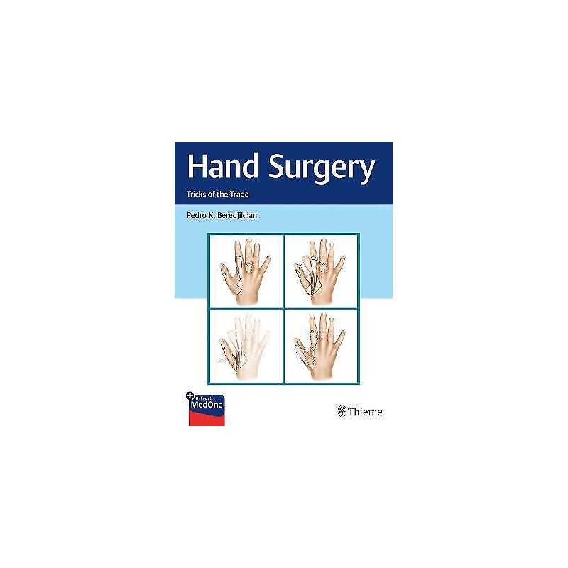 Hand Surgery - 9781626234796