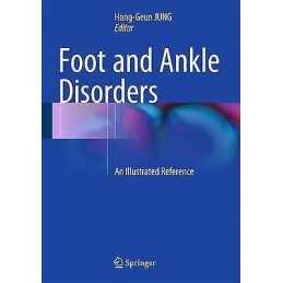 Foot and Ankle Disorders - 9783642544927