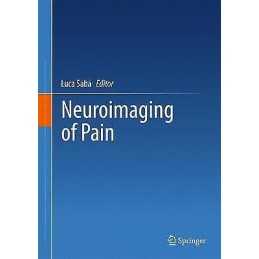 Neuroimaging of Pain - 9783319480442