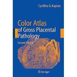 Color Atlas of Gross Placental Pathology - 9780387338422
