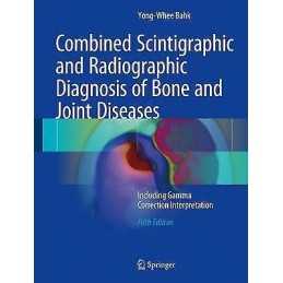 Combined Scintigraphic and Radiographic Diagnosis of Bone and... - 9789811027581