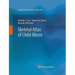 Skeletal Atlas of Child Abuse - 9781617792151