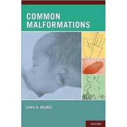 Common Malformations - 9780195136029