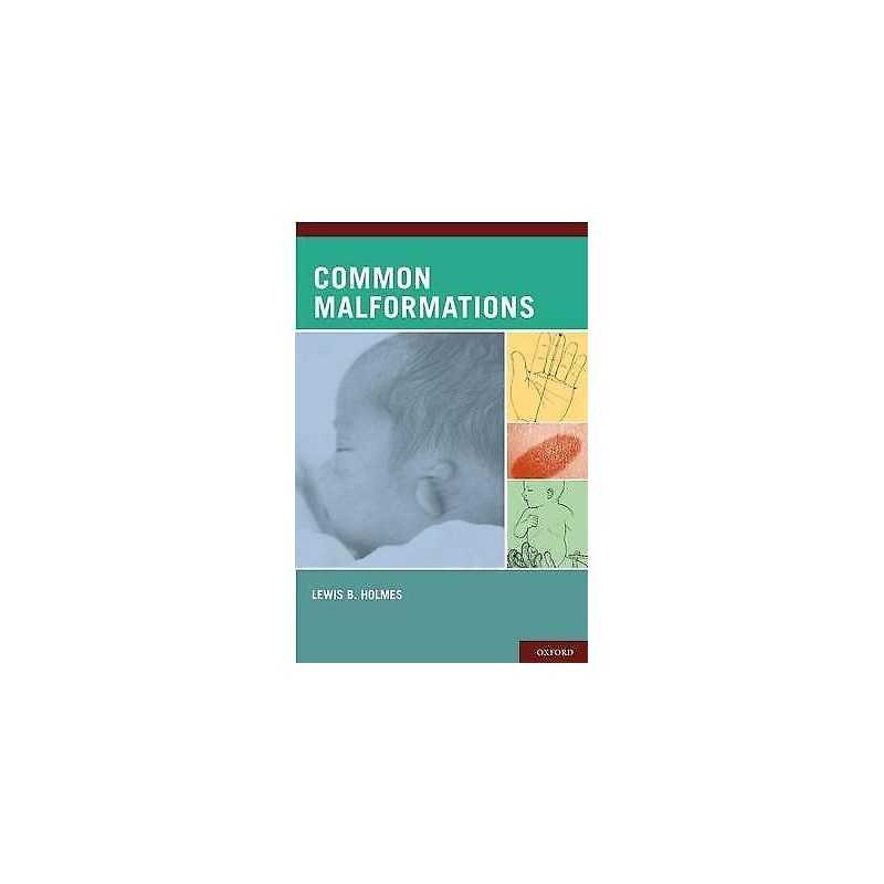 Common Malformations - 9780195136029