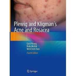 Plewig and Kligmans Acne and Rosacea - 9783319492735