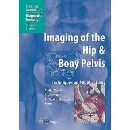 Imaging of the Hip & Bony Pelvis - 9783642058400