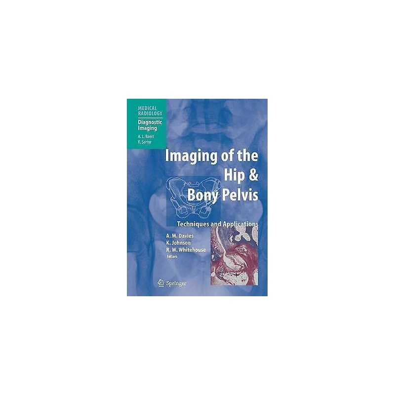 Imaging of the Hip & Bony Pelvis - 9783642058400