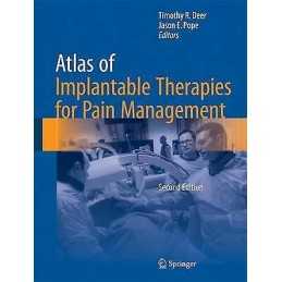 Atlas of Implantable Therapies for Pain Management - 9781493921096