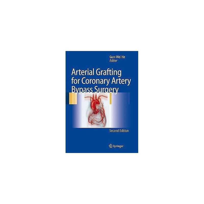 Arterial Grafting for Coronary Artery Bypass Surgery - 9783642067617
