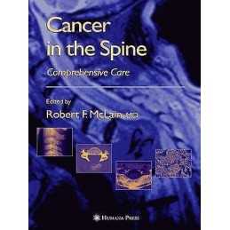 Cancer in the Spine - 9781617373404