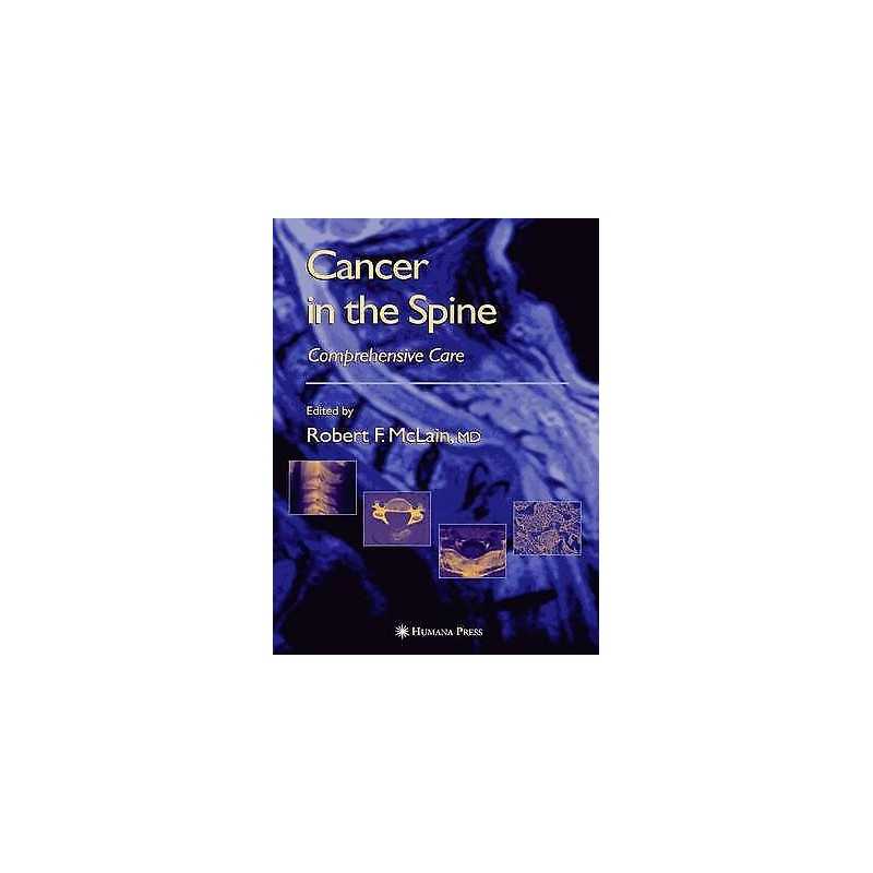 Cancer in the Spine - 9781617373404