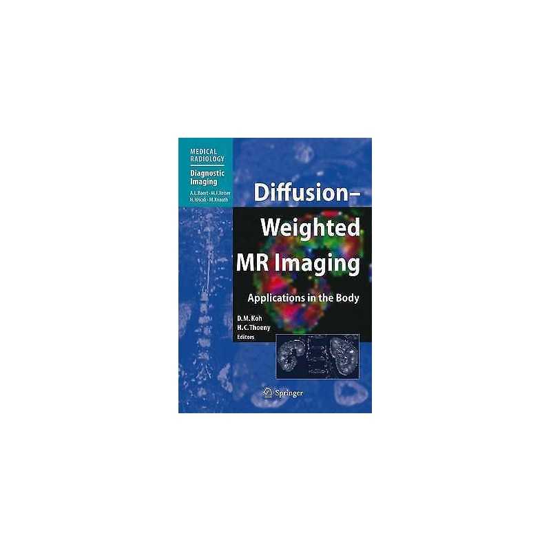Diffusion-Weighted MR Imaging - 9783642261442