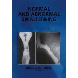 Normal and Abnormal Swallowing - 9781441929044