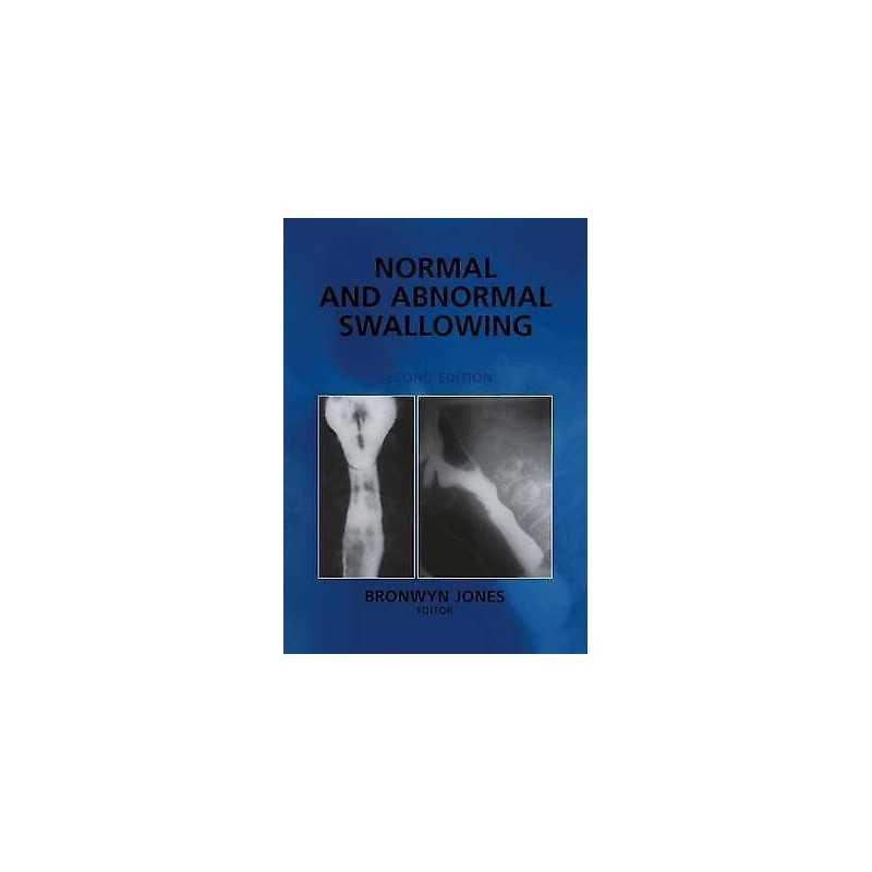 Normal and Abnormal Swallowing - 9781441929044