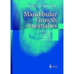 Mandibular Growth Anomalies - 9783642086557