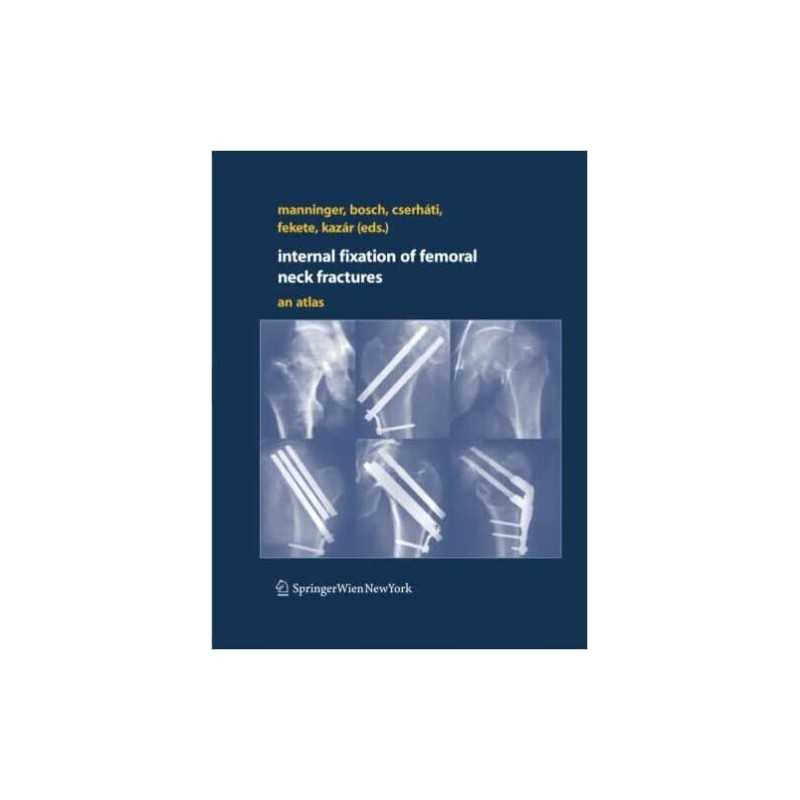 Internal fixation of femoral neck fractures - 9783709120026