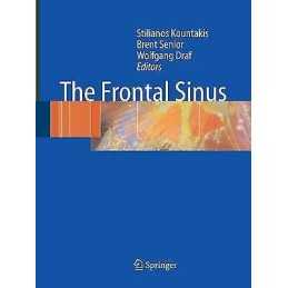 The Frontal Sinus - 9783642059377