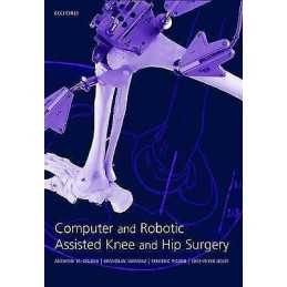 Computer and Robotic Assisted Hip and Knee Surgery - 9780198509431