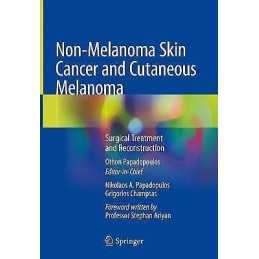 Non-Melanoma Skin Cancer and Cutaneous Melanoma - 9783030187958