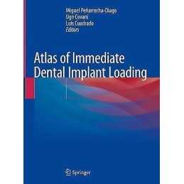 Atlas of Immediate Dental Implant Loading - 9783030055448