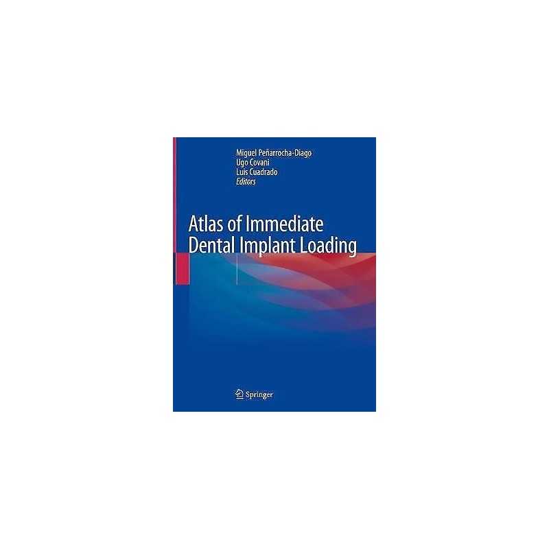 Atlas of Immediate Dental Implant Loading - 9783030055448