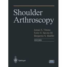 Shoulder Arthroscopy - 9781441929723