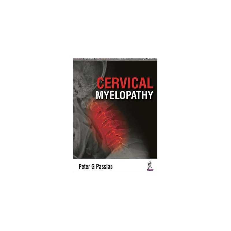 Cervical Myelopathy - 9789351524922