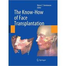 The Know-How of Face Transplantation - 9781447168973