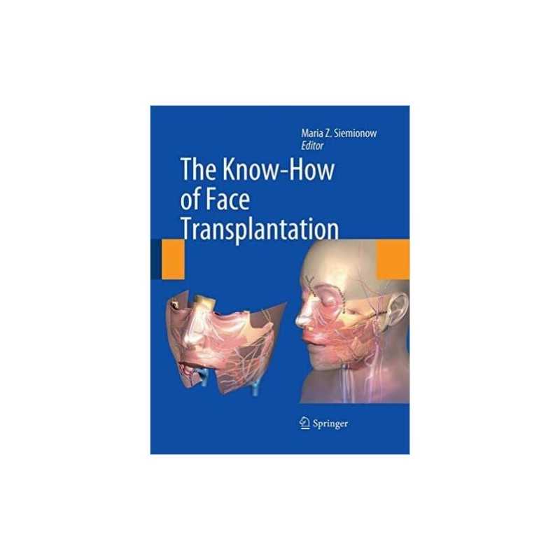 The Know-How of Face Transplantation - 9781447168973