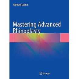 Mastering Advanced Rhinoplasty - 9783319884479