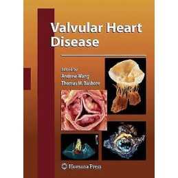Valvular Heart Disease - 9781617796364