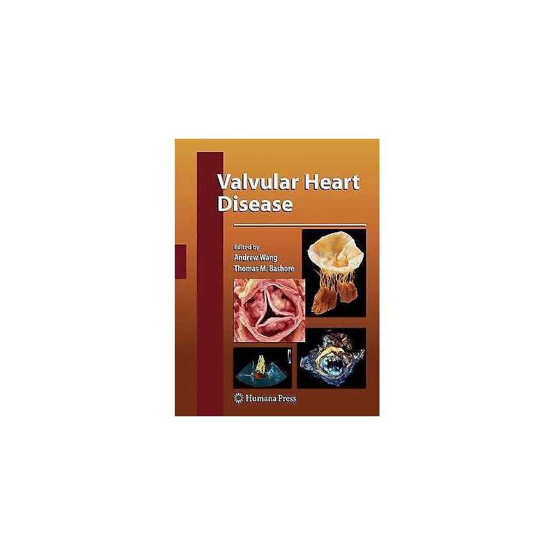 Valvular Heart Disease - 9781617796364