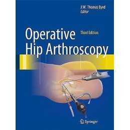 Operative Hip Arthroscopy - 9781441979247
