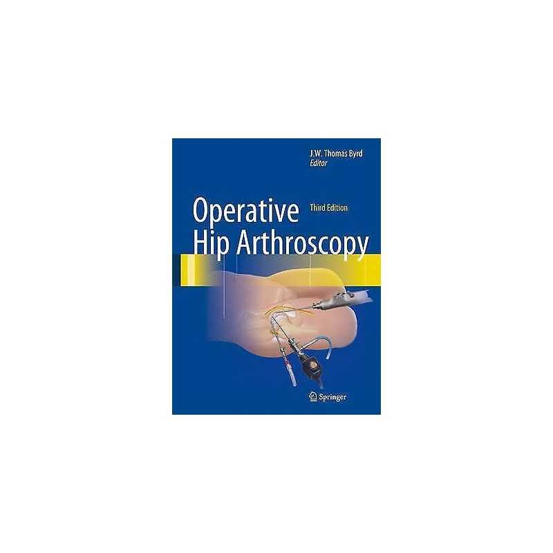 Operative Hip Arthroscopy - 9781441979247