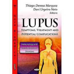Lupus - 9781620810781