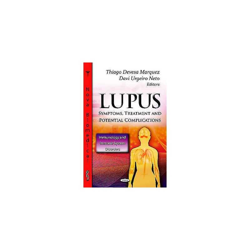 Lupus - 9781620810781