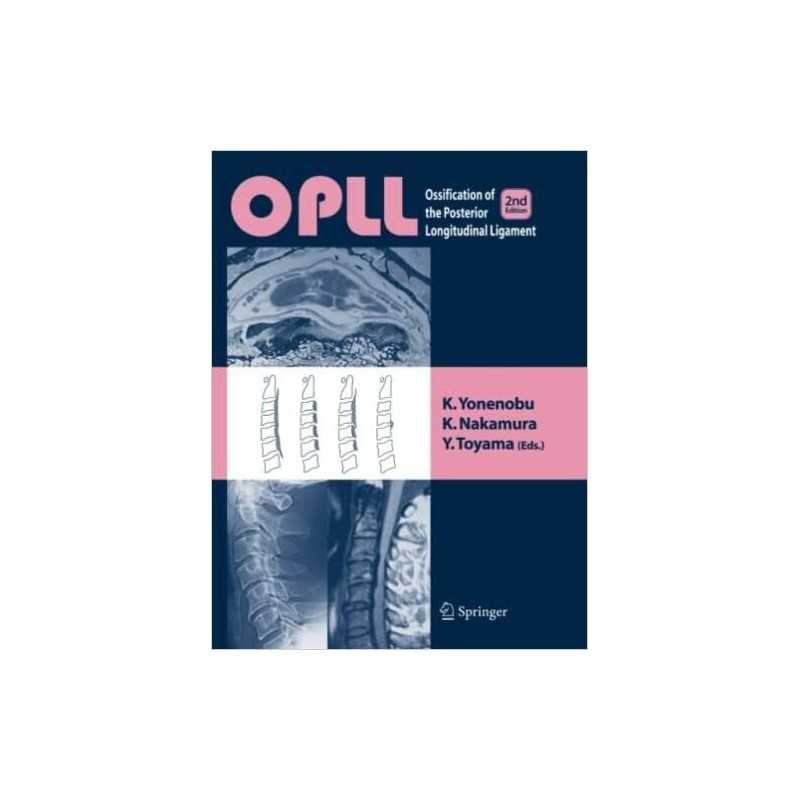 OPLL - 9784431560463