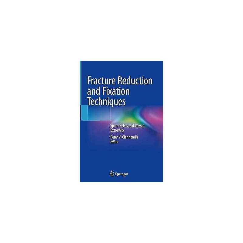 Fracture Reduction and Fixation Techniques - 9783030246075