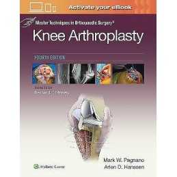 Master Techniques in Orthopedic Surgery: Knee Arthroplasty - 9781496315052