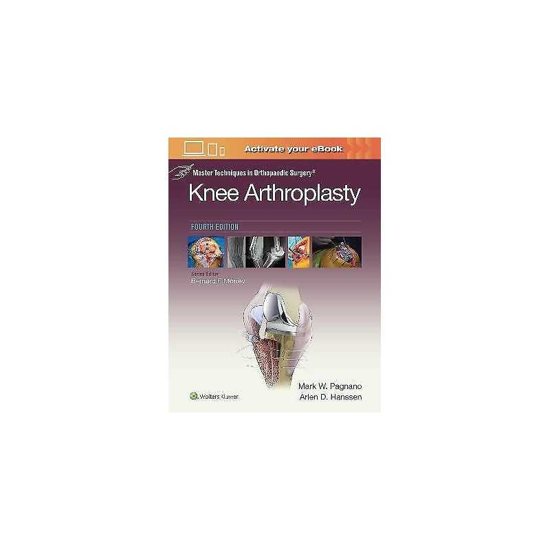 Master Techniques in Orthopedic Surgery: Knee Arthroplasty - 9781496315052