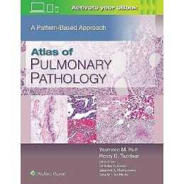 Atlas of Pulmonary Pathology - 9781496397553