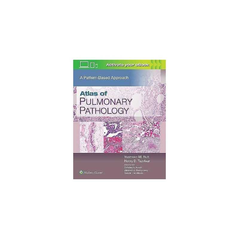 Atlas of Pulmonary Pathology - 9781496397553
