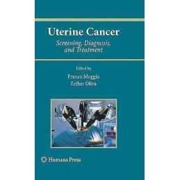 Uterine Cancer - 9781617794858