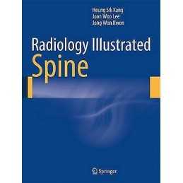 Radiology Illustrated: Spine - 9783642356285