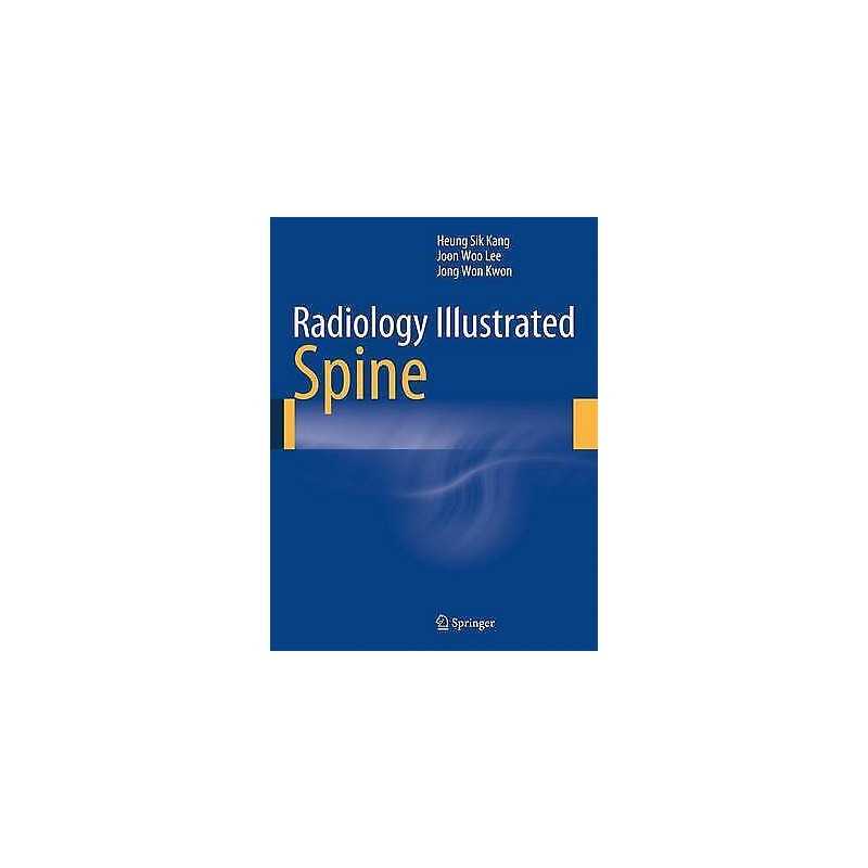 Radiology Illustrated: Spine - 9783642356285