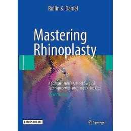 Mastering Rhinoplasty - 9783642014017